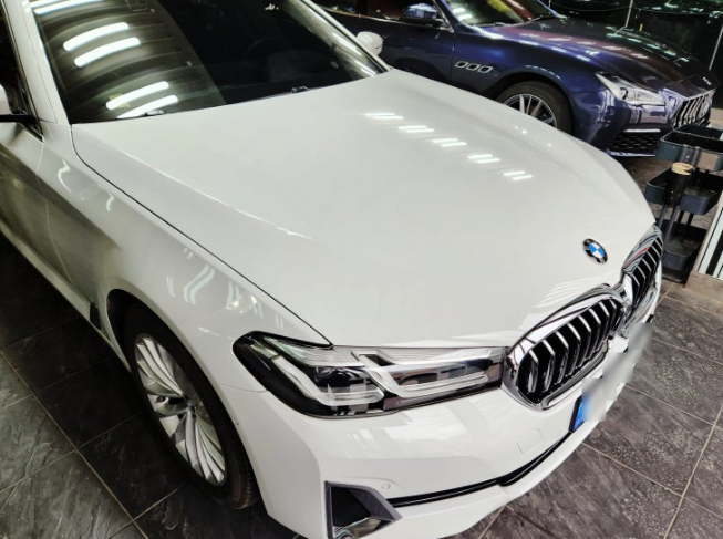 BMW 523D [주차장에서 다른 차량과 접촉사고 과실 합의 합의금 보험 처리 방법]